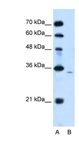 PAP2a / PPAP2A Antibody - PPAP2A antibody ARP42146_T100-NP_795714-PPAP2A(phosphatidic acid phosphatase type 2A) Antibody Western blot of Jurkat lysate.  This image was taken for the unconjugated form of this product. Other forms have not been tested.