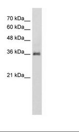 PAP2a / PPAP2A Antibody - HepG2 Cell Lysate.  This image was taken for the unconjugated form of this product. Other forms have not been tested.