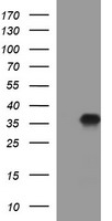 PAP2a / PPAP2A Antibody - HEK293T cells were transfected with the pCMV6-ENTRY control (Left lane) or pCMV6-ENTRY PPAP2A (Right lane) cDNA for 48 hrs and lysed. Equivalent amounts of cell lysates (5 ug per lane) were separated by SDS-PAGE and immunoblotted with anti-PPAP2A.