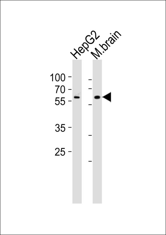 PAPD4 Antibody - Western blot of lysates from HepG2 cell line and mouse brain tissue lysate (from left to right), using GLD2 Antibody. Antibody was diluted at 1:1000 at each lane. A goat anti-rabbit IgG H&L (HRP) at 1:10000 dilution was used as the secondary antibody. Lysates at 35ug per lane.