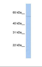 PAPD4 Antibody - MCF7 cell lysate. Antibody concentration: 1.0 ug/ml. Gel concentration: 12%.  This image was taken for the unconjugated form of this product. Other forms have not been tested.