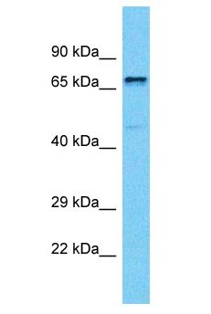 PAPD5 Antibody - PAPD5 antibody Western Blot of MCF7. Antibody dilution: 1 ug/ml.  This image was taken for the unconjugated form of this product. Other forms have not been tested.