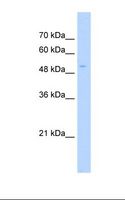 PAPD7 / TRF4-1 Antibody - HepG2 cell lysate. Antibody concentration: 1.0 ug/ml. Gel concentration: 12%.  This image was taken for the unconjugated form of this product. Other forms have not been tested.