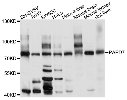 PAPD7 / TRF4-1 Antibody - Western blot analysis of extracts of various cell lines, using PAPD7 antibody at 1:1000 dilution. The secondary antibody used was an HRP Goat Anti-Rabbit IgG (H+L) at 1:10000 dilution. Lysates were loaded 25ug per lane and 3% nonfat dry milk in TBST was used for blocking. An ECL Kit was used for detection and the exposure time was 90s.