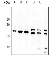 PAPOLA Antibody - Western blot analysis of PAP expression in HCC827 (A), mouse embryo (B), PMVEC (C), EC9706 (D), SGC7901 (E), HEK293T (F) whole cell lysates.