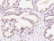 PAPOLA Antibody - Immunochemical staining of human PAPOLA in human prostate with rabbit polyclonal antibody at 1:100 dilution, formalin-fixed paraffin embedded sections.