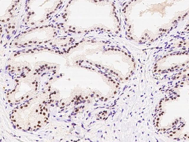 PAPOLA Antibody - Immunochemical staining of human PAPOLA in human prostate with rabbit polyclonal antibody at 1:100 dilution, formalin-fixed paraffin embedded sections.