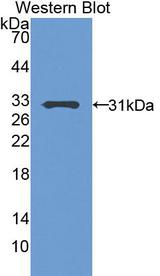 PAPPA / PAPP-A Antibody - Western blot of PAPPA / PAPP-A antibody.