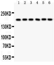 PAPPA / PAPP-A Antibody - PAPP A antibody Western blot. All lanes: Anti PAPP A at 0.5 ug/ml. Lane 1: Human Placenta Tissue Lysate at 50 ug. Lane 2: HT1080 Whole Cell Lysate at 40 ug. Lane 3: SKOV Whole Cell Lysate at 40 ug. Lane 4: 22RV1 Whole Cell Lysate at 40 ug. Lane 5: SW620 Whole Cell Lysate at 40 ug. Lane 6: MM231 Whole Cell Lysate at 40 ug. Predicted band size: 181 kD. Observed band size: 181 kD.