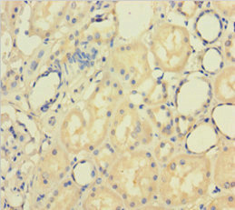 PAPPA / PAPP-A Antibody - Immunohistochemistry of paraffin-embedded human kidney tissue using PAPPA Antibody at dilution of 1:100