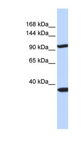 PAPPA2 / Pappalysin 2 Antibody - PAPPA2 antibody Western blot of 293T cell lysate. This image was taken for the unconjugated form of this product. Other forms have not been tested.