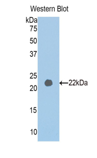 PAPPA2 / Pappalysin 2 Antibody - Western blot of PAPPA2 / Pappalysin 2 antibody.