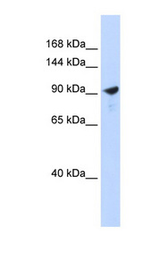 PAPPA2 / Pappalysin 2 Antibody - PAPPA2 antibody Western blot of 293T cell lysate. This image was taken for the unconjugated form of this product. Other forms have not been tested.