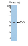PAPPA2 / Pappalysin 2 Antibody - Western blot of recombinant PAPPA2 / Pappalysin 2.  This image was taken for the unconjugated form of this product. Other forms have not been tested.