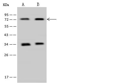 PAPSS 1 Antibody - Anti-PAPSS1 rabbit polyclonal antibody at 1:500 dilution. Lane A: HepG2 Whole Cell Lysate. Lane B: MCF7 Whole Cell Lysate. Lysates/proteins at 30 ug per lane. Secondary: Goat Anti-Rabbit IgG (H+L)/HRP at 1/10000 dilution. Developed using the ECL technique. Performed under reducing conditions. Predicted band size: 71 kDa. Observed band size: 72 kDa.