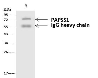 PAPSS 1 Antibody - PAPSS1 was immunoprecipitated using: Lane A: 0.5 mg MCF7 Whole Cell Lysate. 4 uL anti-PAPSS1 rabbit polyclonal antibody and 60 ug of Immunomagnetic beads Protein A/G. Primary antibody: Anti-PAPSS1 rabbit polyclonal antibody, at 1:100 dilution. Secondary antibody: Goat Anti-Rabbit IgG (H+L)/HRP at 1/10000 dilution. Developed using the ECL technique. Performed under reducing conditions. Predicted band size: 71 kDa. Observed band size: 72 kDa.