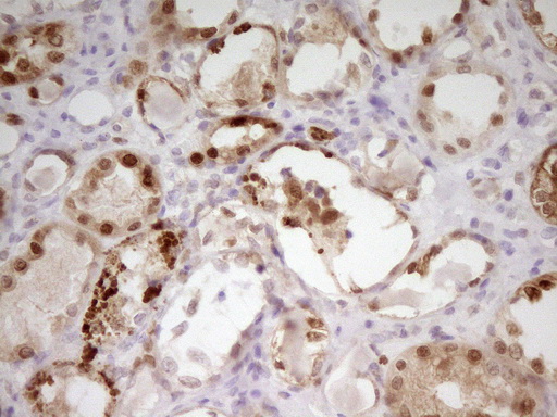 PAPSS2 Antibody - Immunohistochemical staining of paraffin-embedded Human Kidney tissue within the normal limits using anti-PAPSS2 mouse monoclonal antibody. (Heat-induced epitope retrieval by 1 mM EDTA in 10mM Tris, pH8.5, 120C for 3min,
