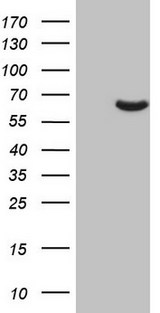 PAPSS2 Antibody - HEK293T cells were transfected with the pCMV6-ENTRY control (Left lane) or pCMV6-ENTRY PAPSS2 (Right lane) cDNA for 48 hrs and lysed. Equivalent amounts of cell lysates (5 ug per lane) were separated by SDS-PAGE and immunoblotted with anti-PAPSS2.