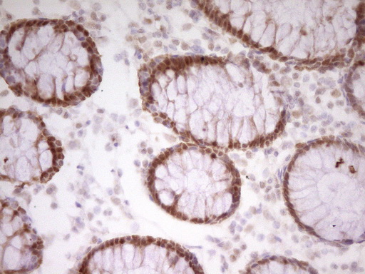 PAPSS2 Antibody - IHC of paraffin-embedded Human colon tissue using anti-PAPSS2 mouse monoclonal antibody. (Heat-induced epitope retrieval by 1 mM EDTA in 10mM Tris, pH8.5, 120°C for 3min).