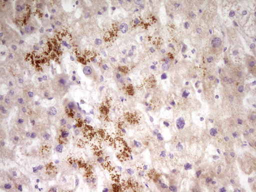 PAPSS2 Antibody - IHC of paraffin-embedded Human liver tissue using anti-PAPSS2 mouse monoclonal antibody. (Heat-induced epitope retrieval by 1 mM EDTA in 10mM Tris, pH8.5, 120°C for 3min).