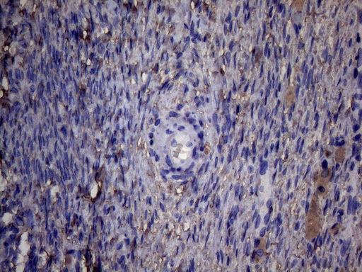 PAPSS2 Antibody - Immunohistochemical staining of paraffin-embedded Human Ovary tissue within the normal limits using anti-PAPSS2 mouse monoclonal antibody. (Heat-induced epitope retrieval by 1mM EDTA in 10mM Tris buffer. (pH8.5) at 120°C for 3 min. (1:150)