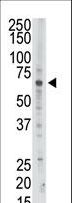 PAPSS2 Antibody - The anti-PAPSS2 antibody is used in Western blot to detect PAPSS2 in Jurkat cell lysate.