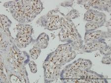 PAPSS2 Antibody - Immunoperoxidase of monoclonal antibody to PAPSS2 on formalin-fixed paraffin-embedded human placenta. [antibody concentration 3 ug/ml]