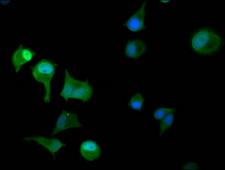PAPSS2 Antibody - Immunofluorescence staining of MCF-7 cells diluted at 1:100, counter-stained with DAPI. The cells were fixed in 4% formaldehyde, permeabilized using 0.2% Triton X-100 and blocked in 10% normal Goat Serum. The cells were then incubated with the antibody overnight at 4°C.The Secondary antibody was Alexa Fluor 488-congugated AffiniPure Goat Anti-Rabbit IgG (H+L).