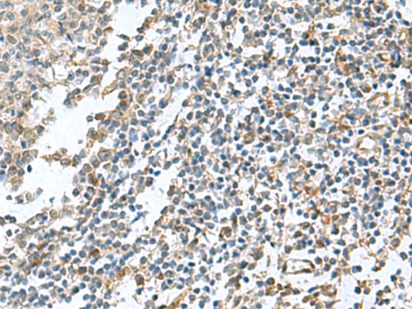 PAPSS2 Antibody - Immunohistochemistry of paraffin-embedded Human tonsil tissue  using PAPSS2 Polyclonal Antibody at dilution of 1:95(×200)