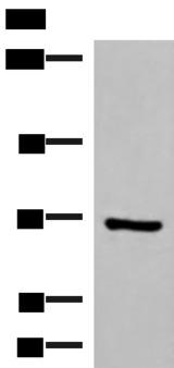 PAPSS2 Antibody - Western blot analysis of HepG2 cell lysate  using PAPSS2 Polyclonal Antibody at dilution of 1:1000