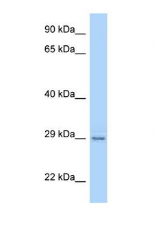 PAQR4 Antibody - Paqr4 antibody Western blot of Rat Lung lysate. Antibody concentration 1 ug/ml.  This image was taken for the unconjugated form of this product. Other forms have not been tested.
