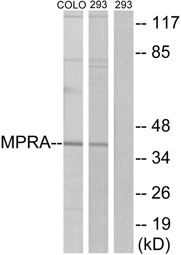PAQR7 / mSR Antibody - Western blot analysis of lysates from 293 and COLO cells, using MPRA Antibody. The lane on the right is blocked with the synthesized peptide.