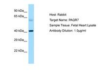 PAQR7 / mSR Antibody -  This image was taken for the unconjugated form of this product. Other forms have not been tested.