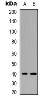 PAQR7 / mSR Antibody - Western blot analysis of mPR alpha expression in A549 (A); COLO205 (B) whole cell lysates.