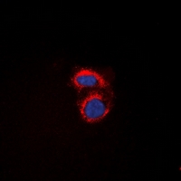 PAQR7 / mSR Antibody - Immunofluorescent analysis of mPR alpha staining in A549 cells. Formalin-fixed cells were permeabilized with 0.1% Triton X-100 in TBS for 5-10 minutes and blocked with 3% BSA-PBS for 30 minutes at room temperature. Cells were probed with the primary antibody in 3% BSA-PBS and incubated overnight at 4 deg C in a humidified chamber. Cells were washed with PBST and incubated with a DyLight 594-conjugated secondary antibody (red) in PBS at room temperature in the dark. DAPI was used to stain the cell nuclei (blue).