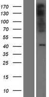 PAQR9 Protein - Western validation with an anti-DDK antibody * L: Control HEK293 lysate R: Over-expression lysate