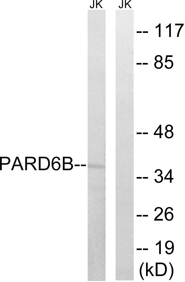 PAR6B / PARD6B Antibody - Western blot analysis of lysates from Jurkat cells, using PARD6B Antibody. The lane on the right is blocked with the synthesized peptide.
