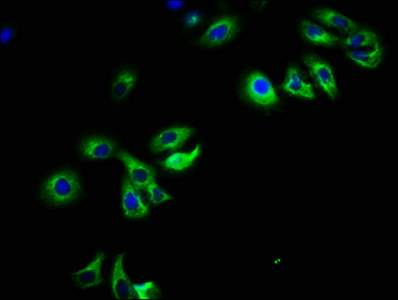 PAR6B / PARD6B Antibody - Immunofluorescence staining of HepG2 cells with PARD6B Antibody at 1:108, counter-stained with DAPI. The cells were fixed in 4% formaldehyde, permeabilized using 0.2% Triton X-100 and blocked in 10% normal Goat Serum. The cells were then incubated with the antibody overnight at 4°C. The secondary antibody was Alexa Fluor 488-congugated AffiniPure Goat Anti-Rabbit IgG(H+L).