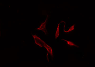 PAR6B / PARD6B Antibody - Staining HeLa cells by IF/ICC. The samples were fixed with PFA and permeabilized in 0.1% Triton X-100, then blocked in 10% serum for 45 min at 25°C. The primary antibody was diluted at 1:200 and incubated with the sample for 1 hour at 37°C. An Alexa Fluor 594 conjugated goat anti-rabbit IgG (H+L) antibody, diluted at 1/600, was used as secondary antibody.