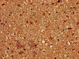 Paralemmin / PALM Antibody - Immunohistochemistry of paraffin-embedded human brain tissue at dilution of 1:100