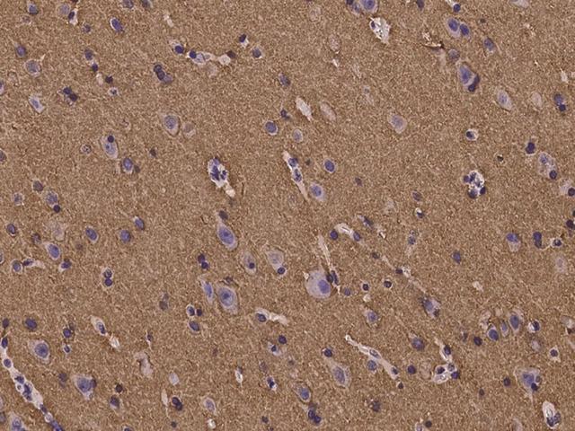Paralemmin / PALM Antibody - Immunochemical staining of human PALM in human brain with rabbit polyclonal antibody at 1:100 dilution, formalin-fixed paraffin embedded sections.