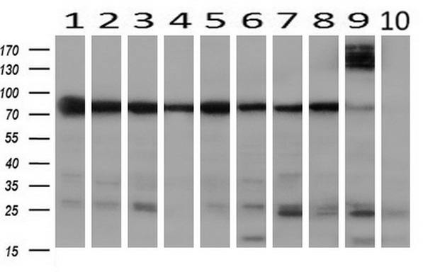 Paraplegin / SPG7 Antibody - Western blot of extracts (10ug) from 10 Human tissue by using anti-SPG7 monoclonal antibody at 1:200 (1: Testis; 2: Omentum; 3: Uterus; 4: Breast; 5: Brain; 6: Liver; 7: Ovary; 8: Thyroid gland; 9: colon;10: spleen).