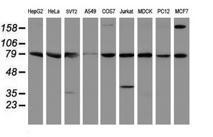 Paraplegin / SPG7 Antibody - Western blot of extracts (35ug) from 9 different cell lines by using anti-SPG7 monoclonal antibody.