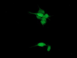 Paraplegin / SPG7 Antibody - Immunofluorescent staining of HeLa cells using anti-SPG7 mouse monoclonal antibody.