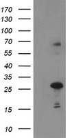 Paraplegin / SPG7 Antibody - Negative control E. coli lysate (Left lane) or E. coli lysate containing recombinant protein fragment for human SPG7(NP_003110) gene (amino acids 300-573) (Right lane). Equivalent amounts (5 ug per lane) were separated by SDS-PAGE and then immunoblotted with anti-SPG7. .