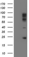 Paraplegin / SPG7 Antibody - HEK293T cells were transfected with the pCMV6-ENTRY control (Left lane) or pCMV6-ENTRY SPG7 (Right lane) cDNA for 48 hrs and lysed. Equivalent amounts of cell lysates (5 ug per lane) were separated by SDS-PAGE and immunoblotted with anti-SPG7.