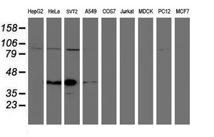 Paraplegin / SPG7 Antibody - Western blot of extracts (35 ug) from 9 different cell lines by using anti-SPG7 monoclonal antibody.