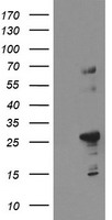 Paraplegin / SPG7 Antibody - Negative control E. coli lysate (Left lane) or E. coli lysate containing recombinant protein fragment for human SPG7(NP_003110) gene (amino acids 300-573) (Right lane). Equivalent amounts (5 ug per lane) were separated by SDS-PAGE and then immunoblotted with anti-SPG7. .