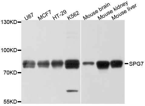 Paraplegin / SPG7 Antibody - Western blot analysis of extracts of various cell lines, using SPG7 antibody at 1:1000 dilution. The secondary antibody used was an HRP Goat Anti-Rabbit IgG (H+L) at 1:10000 dilution. Lysates were loaded 25ug per lane and 3% nonfat dry milk in TBST was used for blocking. An ECL Kit was used for detection and the exposure time was 10s.