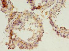 PARD3 Antibody - Immunohistochemistry of paraffin-embedded human testis using antibody at 1:100 dilution.  This image was taken for the unconjugated form of this product. Other forms have not been tested.